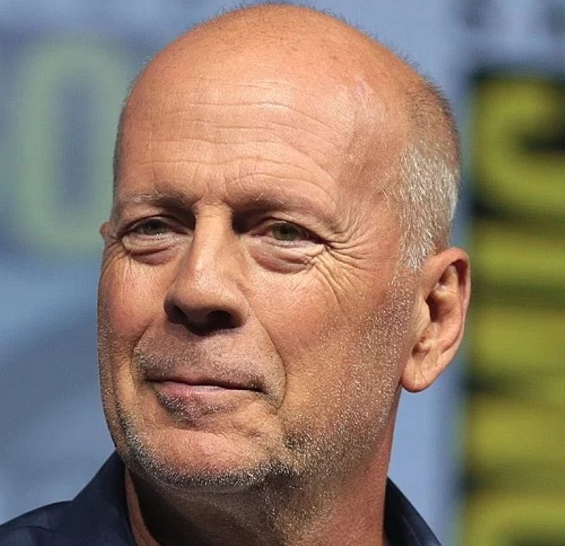 The health condition of Hollywood actor Bruce Willis has deteriorated